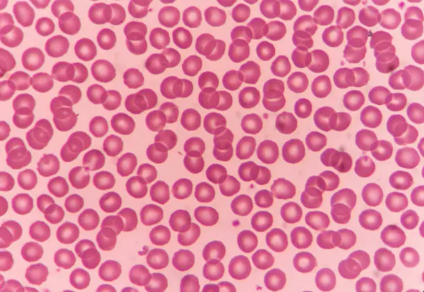 Photo of Normal red blood cells