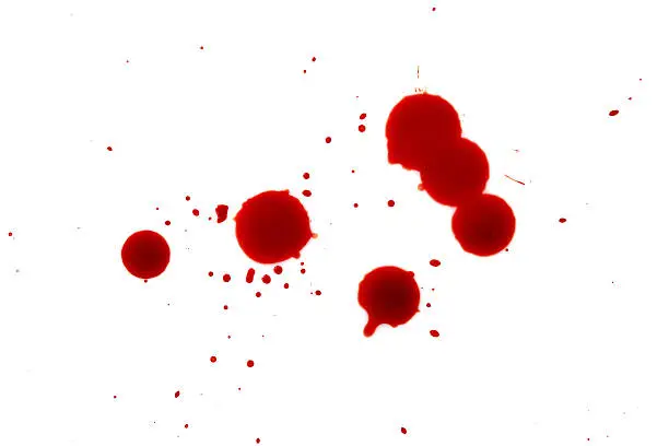 Photo of Blood splatters on white background