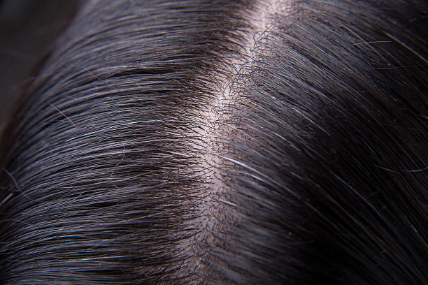 istock Hair And Scalp 621479976