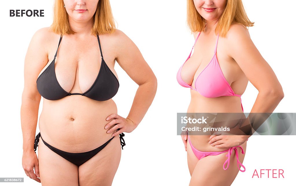 Woman in bikini posing before and after weight loss Dieting Stock Photo