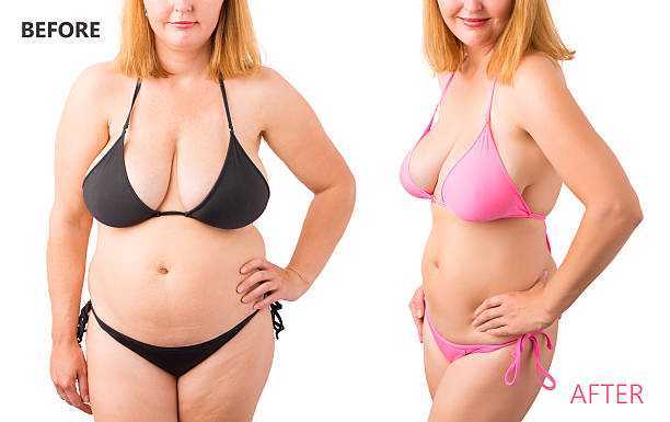 Woman in bikini posing before and after weight loss Woman in bikini posing before and after weight loss mass unit of measurement photos stock pictures, royalty-free photos & images