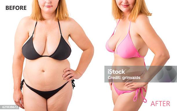 Woman In Bikini Posing Before And After Weight Loss Stock Photo - Download Image Now