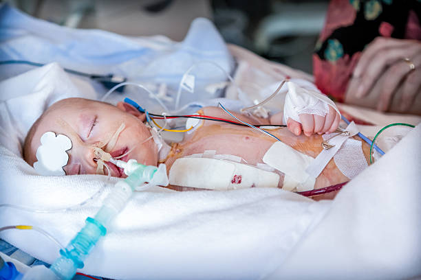Infant, child in intensive care unit after heart surgery. Infant, child in intensive care unit after heart surgery. Shallow depth of field with medical equipment and mother sitting beside the bed. Candid image. heart surgery photos stock pictures, royalty-free photos & images