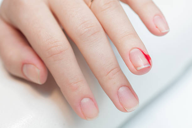 istock the girl suffered a cut finger on the manicure. 622073628