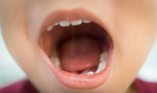 Inside of a boy mouth opening wide. stock photo