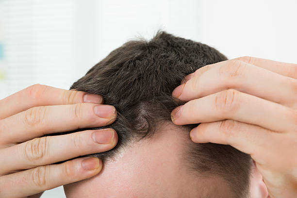 istock Man Checking Hairline At Home 622199482