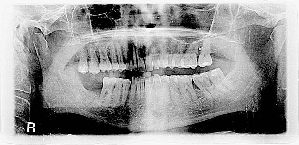 istock dental radiography 622543282