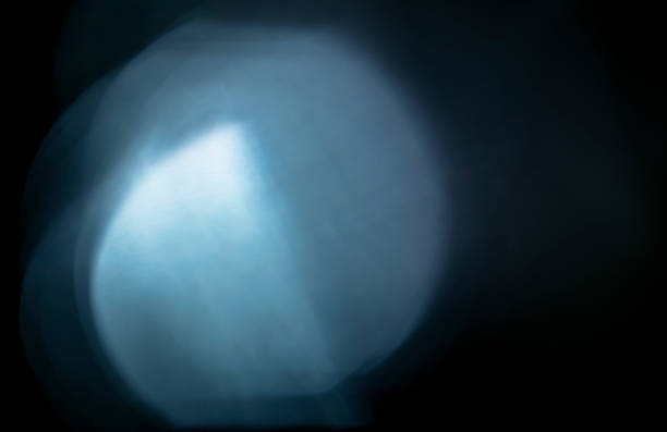 istock Natural Light Leaks and Lens Flares 622892410