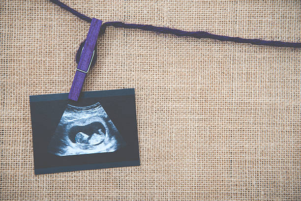 Medical images collage of ultrasound during woman pregnancy show Medical images collage of ultrasound during woman pregnancy showing fetus in third month and stetoscope on white background abortion photos stock pictures, royalty-free photos & images
