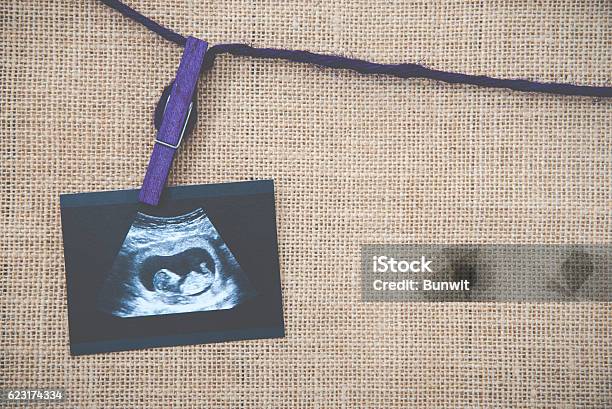 Medical Images Collage Of Ultrasound During Woman Pregnancy Show Stock Photo - Download Image Now