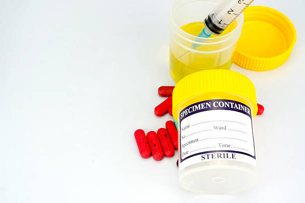 istock Urine sample bottle, syringe and pills isolated 623290644