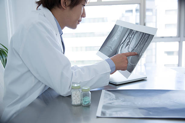 istock Doctor pointing to X-ray 623825572