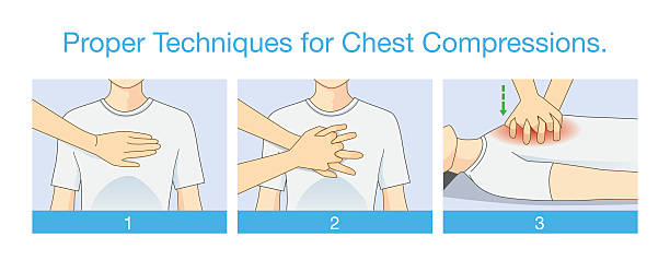 Proper Techniques for Chest Compression. Proper techniques for chest compression. Illustration about emergency help and perform CPR. First aid for person has stopped breathing.  cardio pulmonary stock illustrations