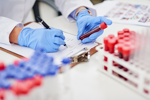 Closeup shot of a scientist examining a blood sample and recording findings in a lab
