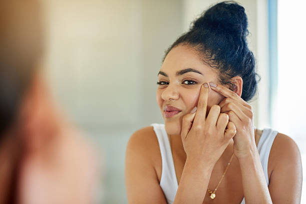 One pimple can change your entire day Shot of a young woman squeezing a pimple in front of the bathroom mirror pimple stock pictures, royalty-free photos & images