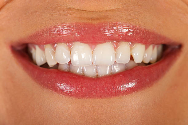 Perfect smile Close up picture of a young woman's beautiful denture tooth enamel stock pictures, royalty-free photos & images