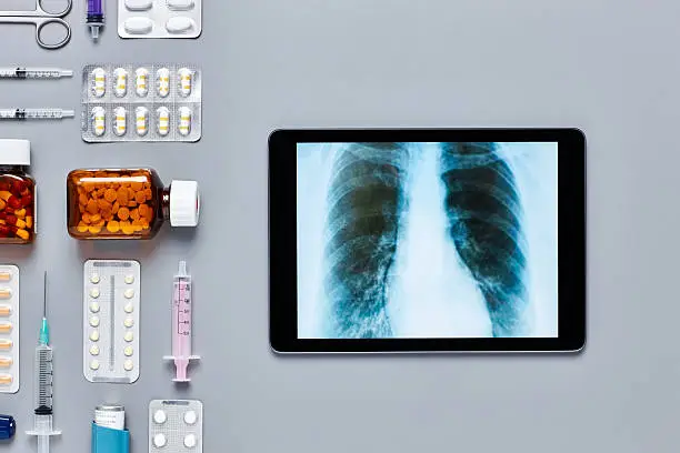 Directly above flat lay shot of digital tablet with various medical equipment. Flat lay of medicines placed with syringes and asthma inhaler. Computer screen is displaying chest X-ray on gray background.  Knolling concept.