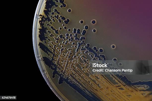 Black Bacterial Colonies Of Salmonella Species On Salmonella Shi Stock Photo - Download Image Now