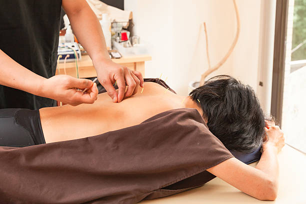 l'agopunturista attacca un ago nella schiena del paziente - acupuncture spa treatment asian culture medicine foto e immagini stock