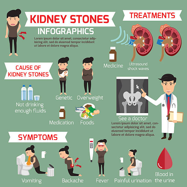 illustrazioni stock, clip art, cartoni animati e icone di tendenza di infografica sui calcoli renali. dettagli elementi del set medico e sympto - kidney stone