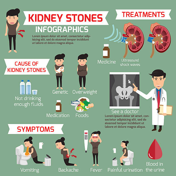 ilustrações, clipart, desenhos animados e ícones de infográfico de pedra nos rins. detalhe elementos de conjunto médico e sympto - kidney stone