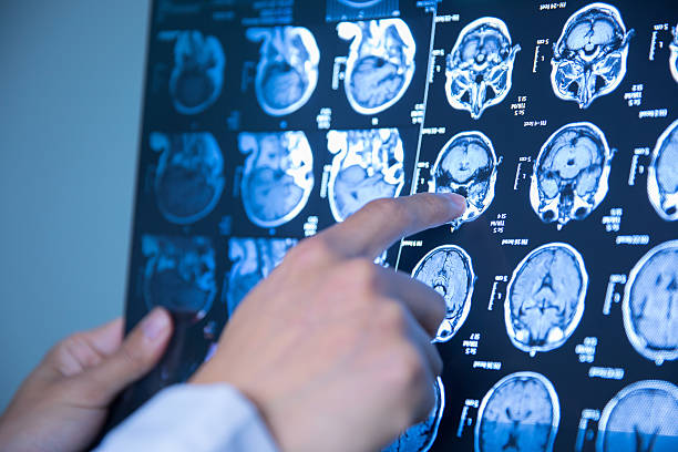 istock doctor hand checking magnetic resonance image (MRI) of the brain 625676090