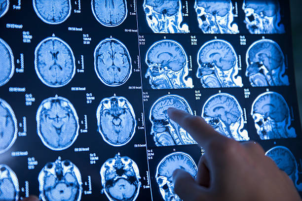 istock doctor hand checking magnetic resonance image (MRI) of the brain 625676258