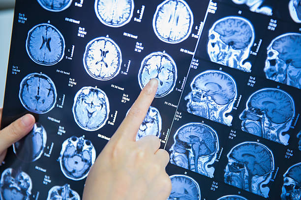 istock doctor working with magnetic resonance image (MRI) of the brain 625676620
