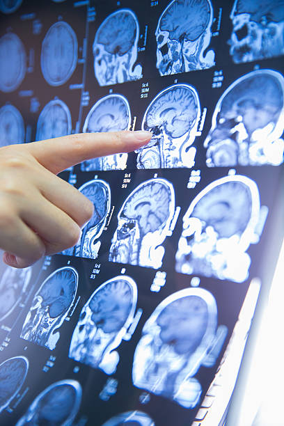 istock doctor hand checking magnetic resonance image (MRI) of the brain 625676904