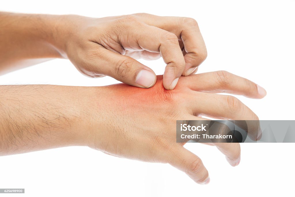 itching Have a itching Scratching Stock Photo