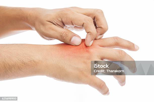 Itching Stock Photo - Download Image Now - Scratching, Burning, Cut Out