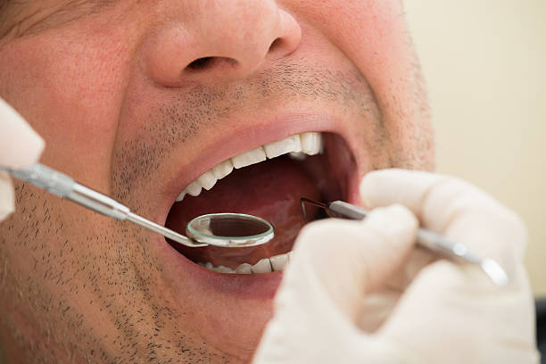 istock Man Examined By Dentist 625891588