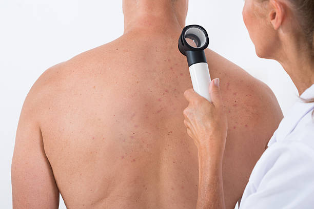 istock Doctor Examining Acne Skin On Patient's Back 625894062