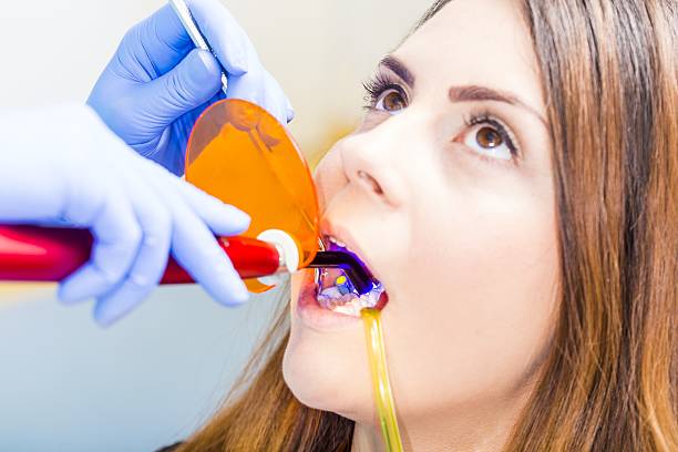 Dental hygiene Beautiful woman patient having dental treatment at dentist's office. teeth bonding stock pictures, royalty-free photos & images