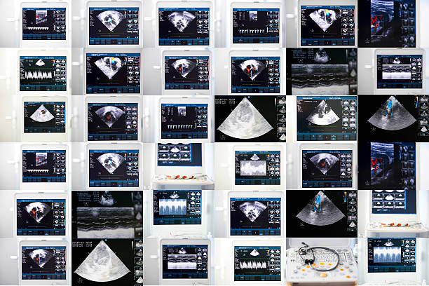 collage di immagini di macchine ad ultrasuoni - doppler effect foto e immagini stock