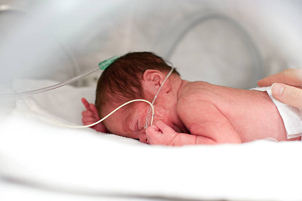 Premature infant stock photo