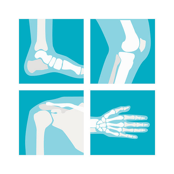 cartoon human joints set. wektor - human bone illustrations stock illustrations