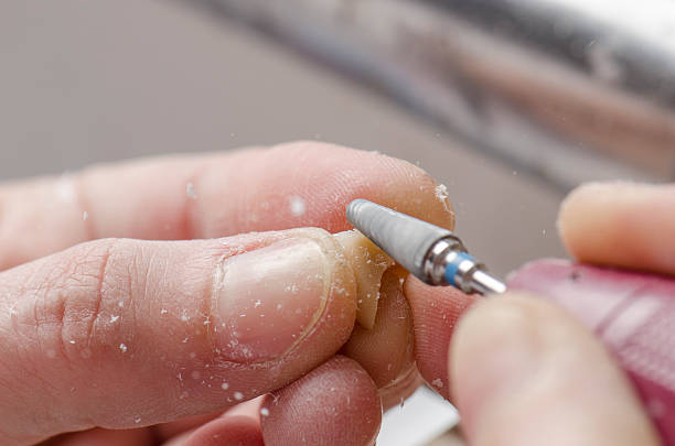 istock Dental technician doing partial dentures of acrylic resins. 626435480