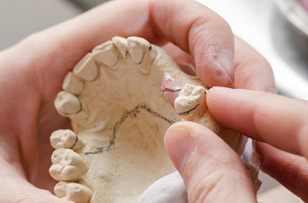 istock Dental technician doing partial dentures of acrylic resins. 626435954