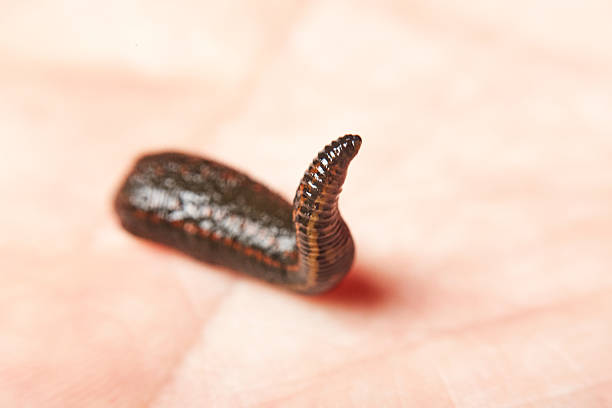 istock Leech for hirudotherapy on the hand 626446526