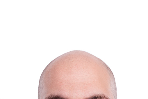 Completely bald man head white background,studio shot