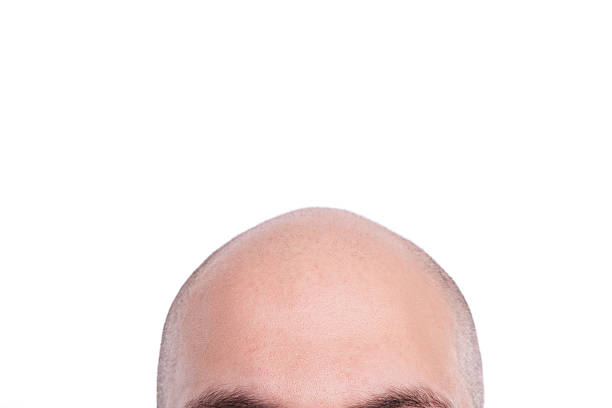 Completely bald man head Completely bald man head white background,studio shot balding photos stock pictures, royalty-free photos & images
