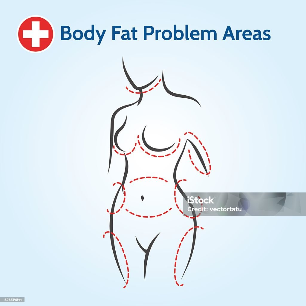 Female body fat problem areas Female body fat problem areas in line style. Vector illustration The Human Body stock vector