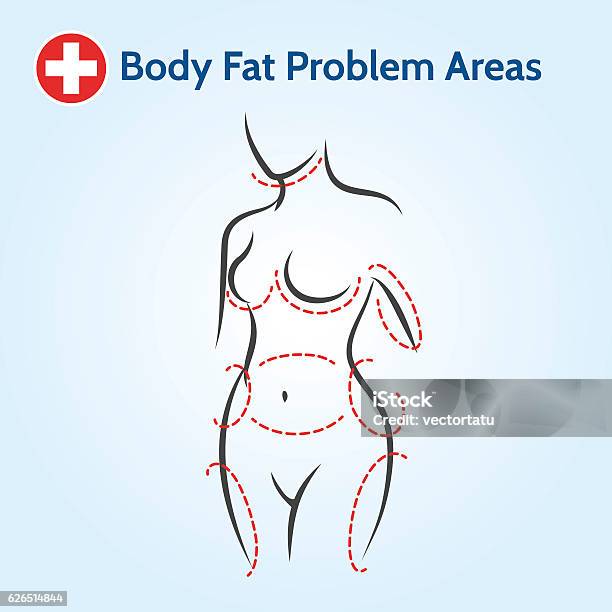 Female Body Fat Problem Areas Stock Illustration - Download Image Now - The Human Body, Liposuction, Women