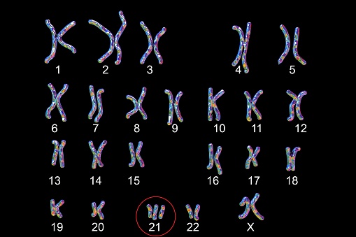 Down-syndrome karyotype, female, labeled, isolated on black background. Trisomy 21 3D illustration