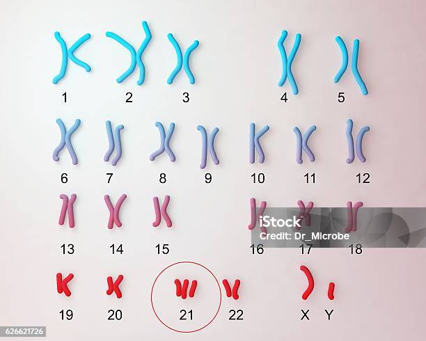Downsyndrome Karyotype Stock Photo - Download Image Now - Chromosome, Karyotype, Illness
