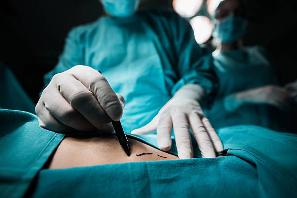 close up of a doctor marking the human skin. - cirurgia plástica imagens e fotografias de stock