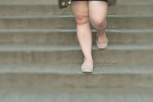 istock woman leg walk stairs 627040556