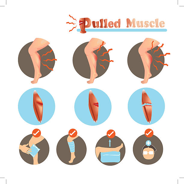illustrazioni stock, clip art, cartoni animati e icone di tendenza di muscolo tirato - human knee physical injury bandage muscular build