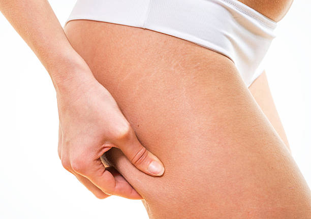 istock woman checking cellulite on her buttocks 627186344